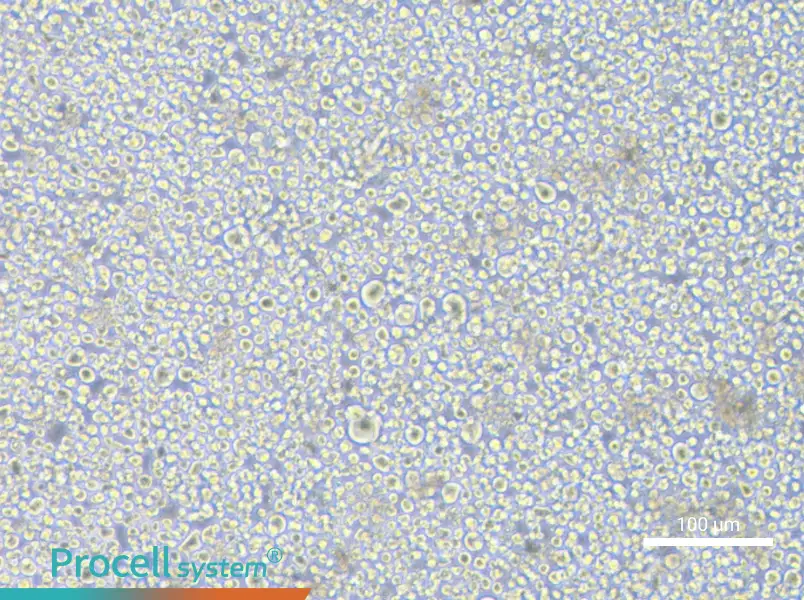 SET-2 Cell Complete Medium - 1