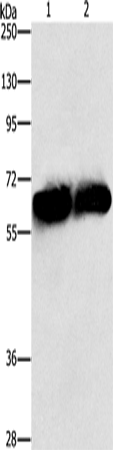 Western Blot analysis of Lovo and 231 cell using ASNS Polyclonal Antibody at dilution of 1:1000