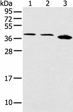 Western blot analysis of Jurkat Hela and 231 cell  using CCNG1 Polyclonal Antibody at dilution of 1:400