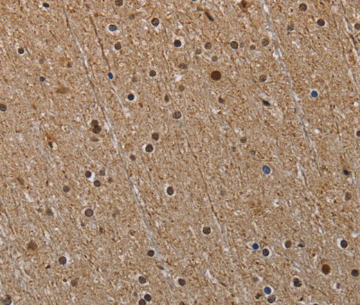 Immunohistochemistry of paraffin-embedded Human brain  tissue using NLRP6 Polyclonal Antibody at dilution 1:40