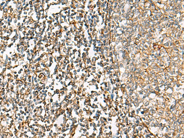 Immunohistochemistry of paraffin-embedded Human tonsil tissue  using CHKA Polyclonal Antibody at dilution of 1:35(?200)