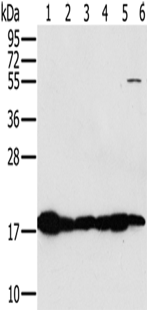 Western Blot analysis of Mouse heart and muscle tissue, hela cell and Mouse liver tissue, Mouse kidney tissue and hepg2 cell using MTFP1 Polyclonal Antibody at dilution of 1:450