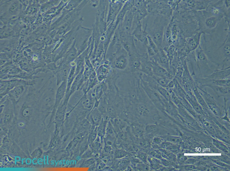 Mouse Colonic Smooth Muscle Cell Complete Medium - small - 5