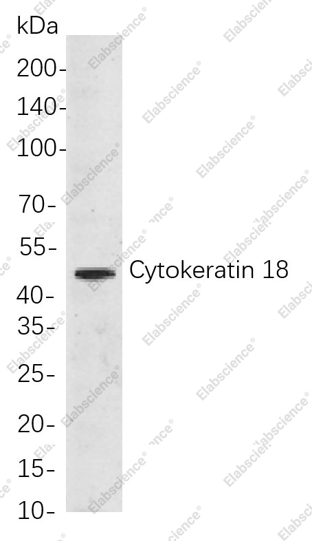 Recombinant Cytokeratin 18 Monoclonal Antibody - 1