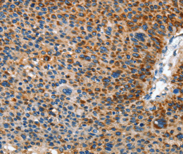 AMDHD2 Polyclonal Antibody - 3