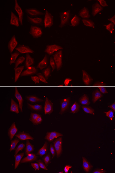 Immunofluorescence analysis of U2OS cells using PDXK Polyclonal Antibody