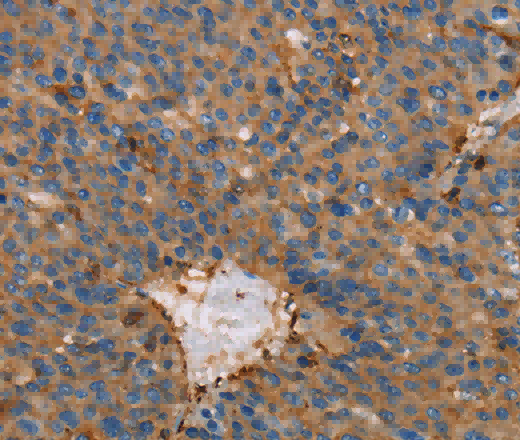 ACTA1 Polyclonal Antibody - 2