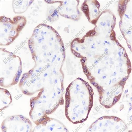 Recombinant hCG beta Monoclonal Antibody - 1