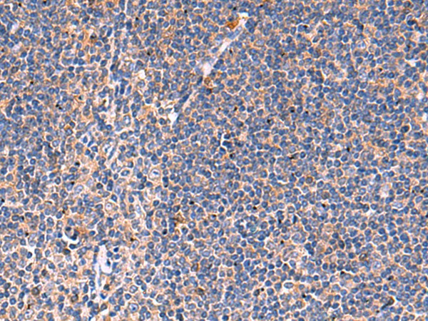 Immunohistochemistry of paraffin-embedded Human tonsil tissue  using KLK9 Polyclonal Antibody at dilution of 1:50(?200)