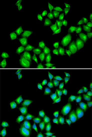 Immunofluorescence analysis of U2OS cells using Dopamine Receptor D3 (Dopamine Receptor D3 (DRD3)) Polyclonal Antibody Blue: DAPI for nuclear staining.