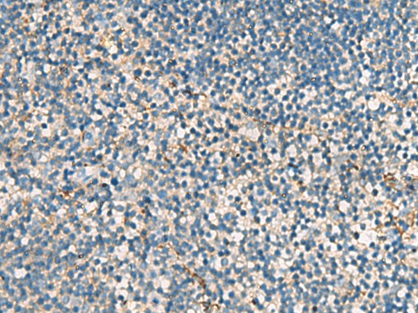 Immunohistochemistry of paraffin-embedded Human tonsil tissue  using ACTC1 Polyclonal Antibody at dilution of 1:55(?200)