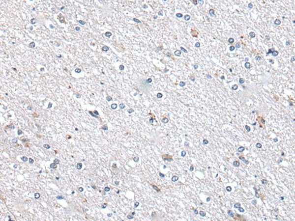 Immunohistochemistry of paraffin-embedded Human brain tissue  using METTL7A Polyclonal Antibody at dilution of 1:40(?200)