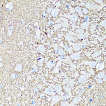 Immunohistochemistry of paraffin-embedded Rat brain using VAMP2 Polyclonal Antibody at dilution of  1:100 (40x lens).