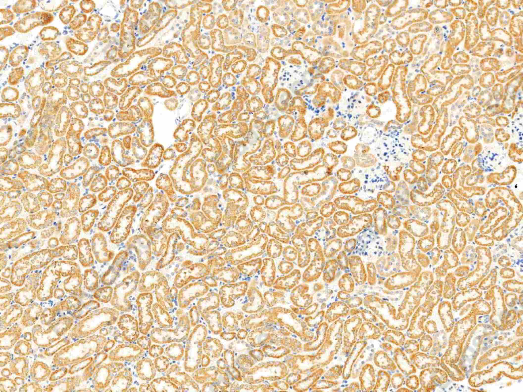 Recombinant Thioredoxin-2/TXN2 Monoclonal Antibody - 2