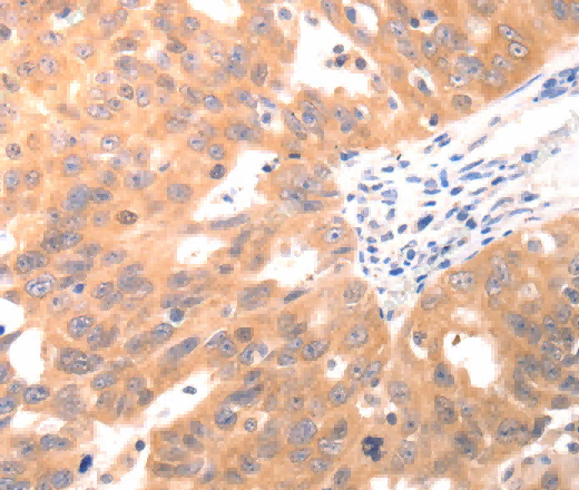 CAPNS1 Polyclonal Antibody - 2