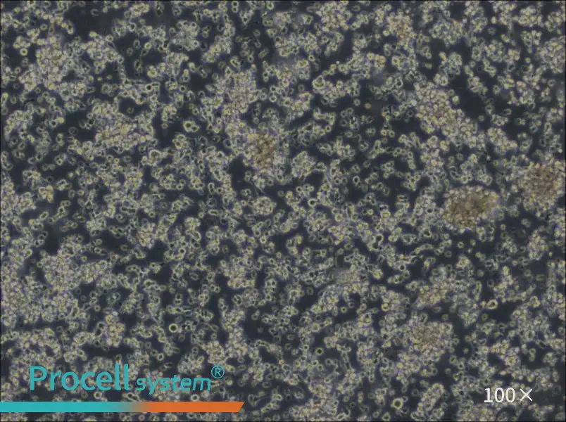 HCC38 BL Cell Complete Medium - 1