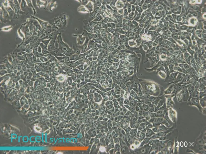 JIMT-1 Cell Complete Medium - small - 6