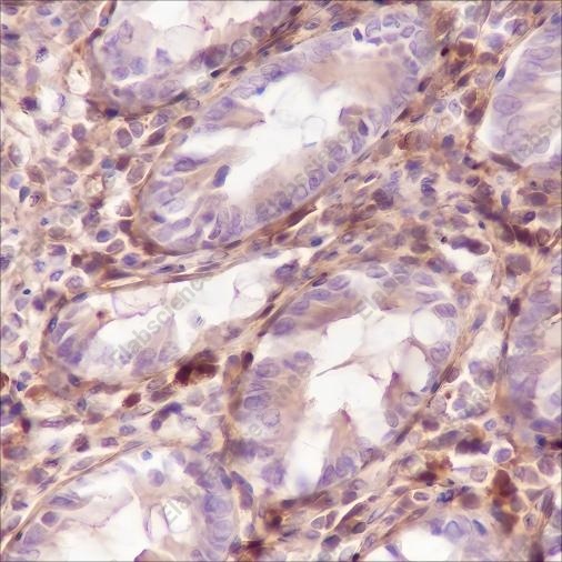Recombinant Galectin-1 Monoclonal Antibody - 4