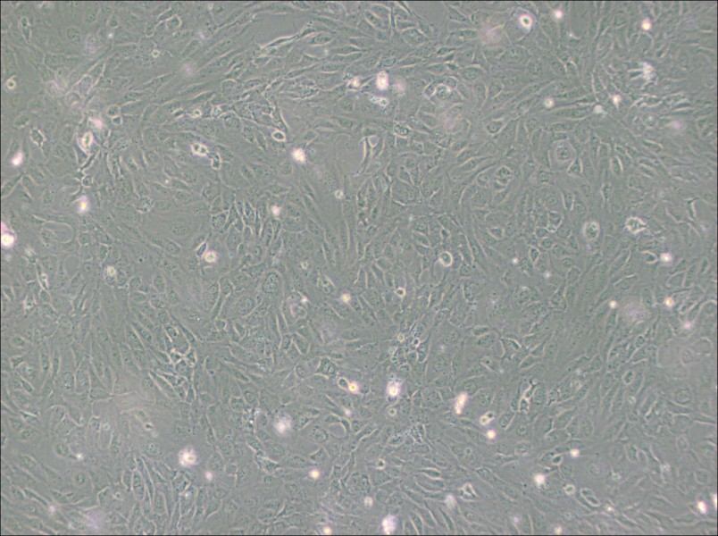 PUMC-HUVEC-T1 Cell Complete Medium-searchlist-1