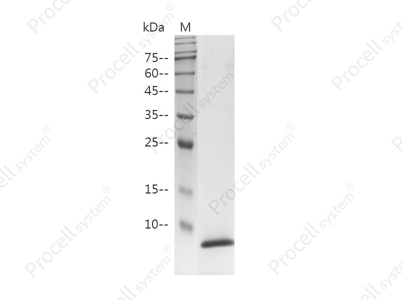 EGF/Urogastrone/URG, Human, Recombinant