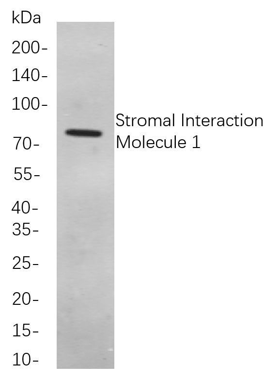 Recombinant Stromal Interaction Molecule 1 Monoclonal Antibody-searchlist-1