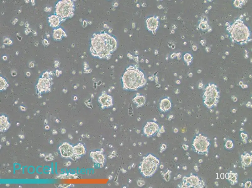 SK-ES-1 Cell Complete Medium - 1
