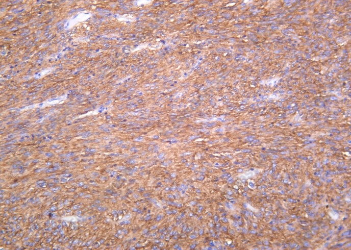 Recombinant TMEM16A Monoclonal Antibody - 1