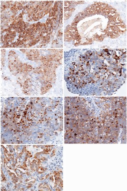 Recombinant WAP5/WFDC2/HE4 Monoclonal Antibody-searchlist-1