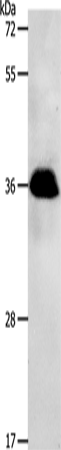 Western Blot analysis of Jurkat cell using PPP2CB Polyclonal Antibody at dilution of 1:1200