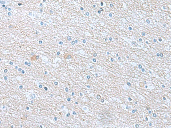 Immunohistochemistry of paraffin-embedded Human brain tissue  using TSTA3 Polyclonal Antibody at dilution of 1:45(?200)