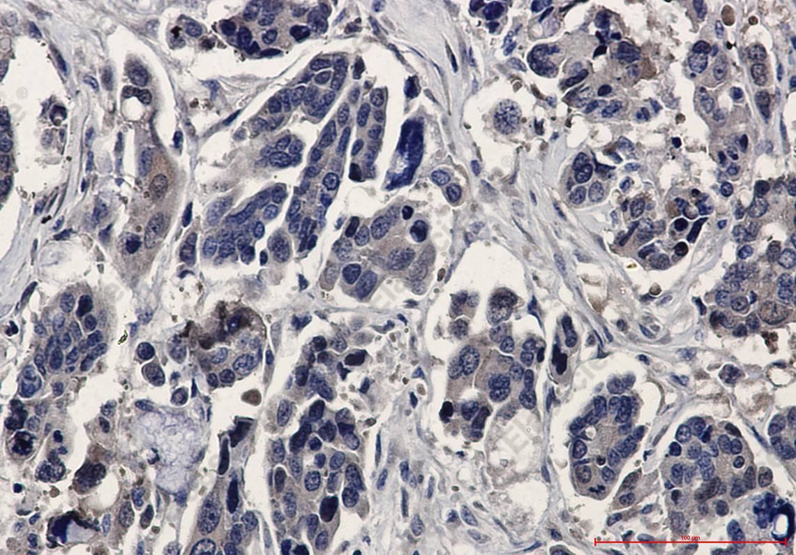Recombinant ERK2 Monoclonal Antibody - 4