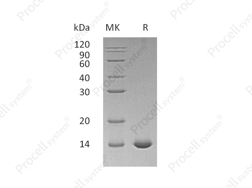 IL-2 (C145S), Human, Recombinant