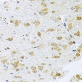Immunohistochemistry of paraffin-embedded Mouse brain using Gm13125 Polyclonal Antibody at dilution of 1:100 (40x lens).