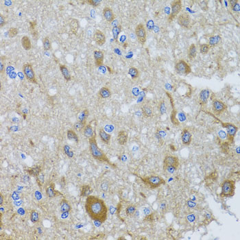 Immunohistochemistry of paraffin-embedded Rat brain using DYNC1I1 Polyclonal Antibody at dilution of  1:100 (40x lens).