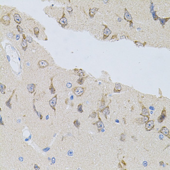 Immunohistochemistry of paraffin-embedded Rat brain using NAPA Polyclonal Antibody