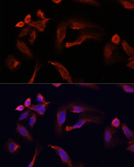 Immunofluorescence analysis of U2OS cells using TYMS Polyclonal Antibody at dilution of 1:100. Blue: DAPI for nuclear staining.