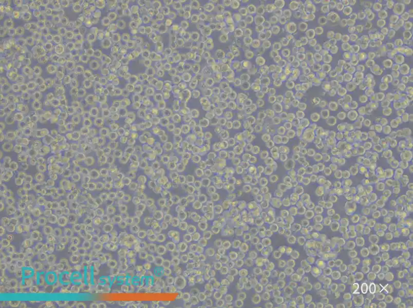 Daudi Cell Complete Medium - 6