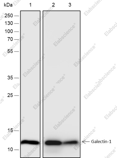 Recombinant Galectin-1 Monoclonal Antibody - 1