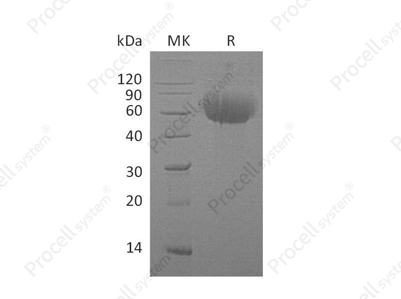 IL-13RA1/IL13RA, Human, Recombinant