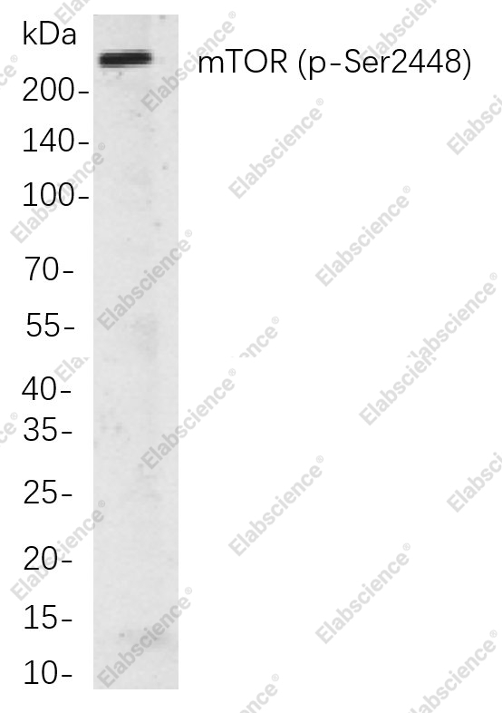 Recombinant Phospho-mTOR (Ser2448) Monoclonal Antibody - 1