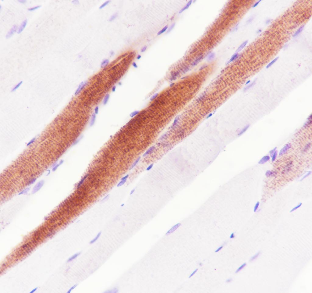 Recombinant MYH7 Monoclonal Antibody - small - 5
