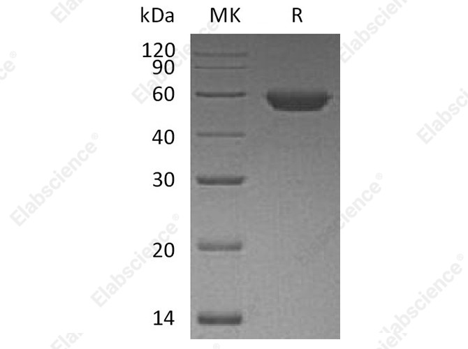 Recombinant Human ROR2 Protein (His Tag) - 1