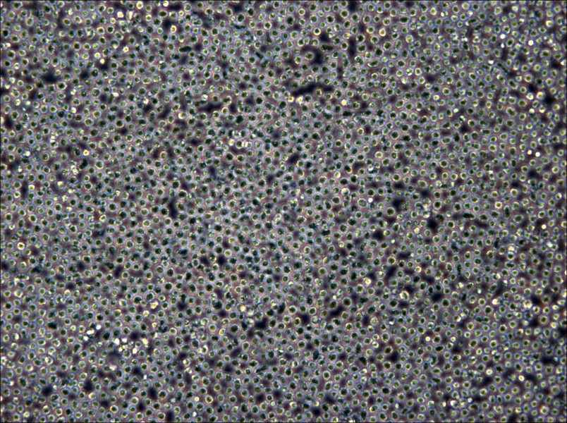 Z-138 Cell Complete Medium - 5