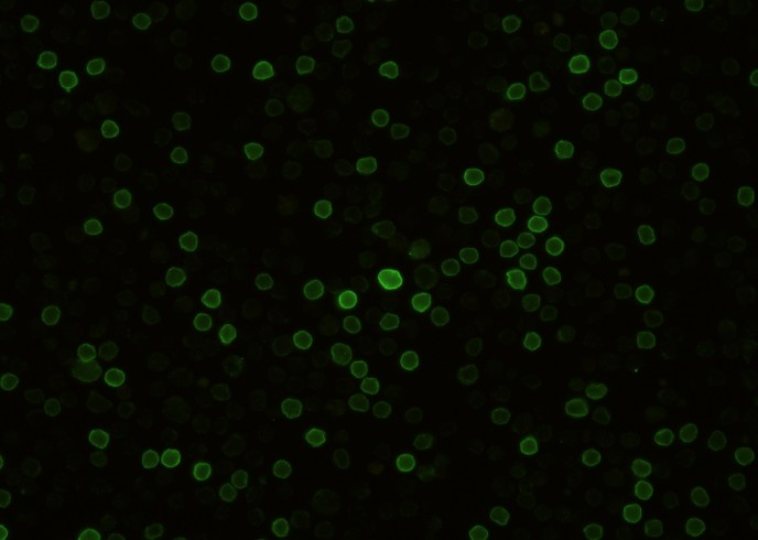 Recombinant CD27 Monoclonal Antibody-searchlist-1