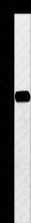 AASDHPPT Polyclonal Antibody - 1