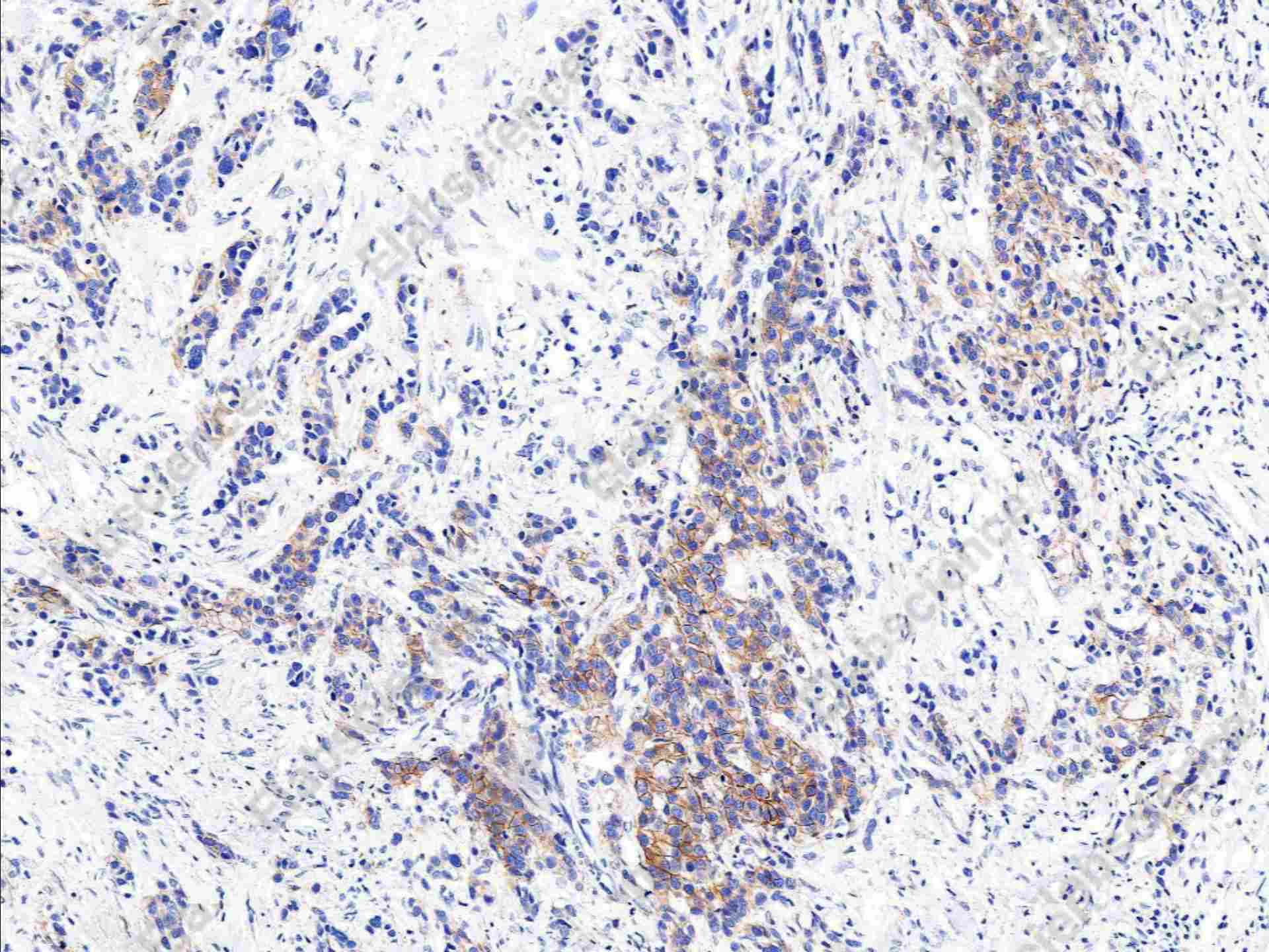 Recombinant HER2/ErbB2/CD340 Monoclonal Antibody - 1