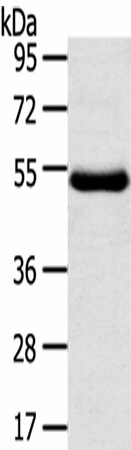 Western Blot analysis of Human thigh malignant fibrous histiocytoma tissue using TMPRSS11D Polyclonal Antibody at dilution of 1/800