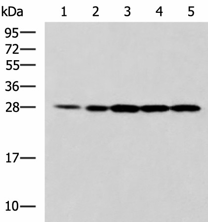 Western blot analysis of 293T Jurkat and A375 cell lysates  using PSMA6 Polyclonal Antibody at dilution of 1:900