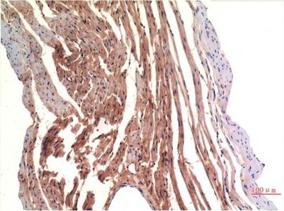 Immunohistochemistry of paraffin-embedded Rat heart tissue using VE-Cadherin Monoclonal Antibody at dilution of 1:200.