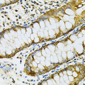 Immunohistochemistry of paraffin-embedded Human colon using HSP90AB1 Polyclonal Antibody at dilution of 1:100 (40x lens).